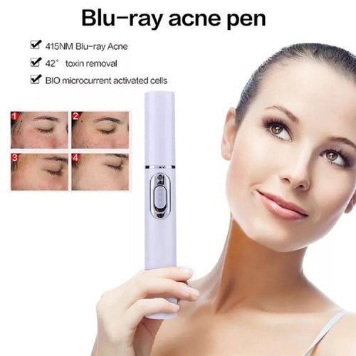 Blue-Ray Acne Treating Pen
