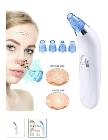 Dermasuction Pore Cleaning
