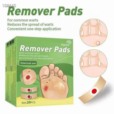 Wart Remover Pads