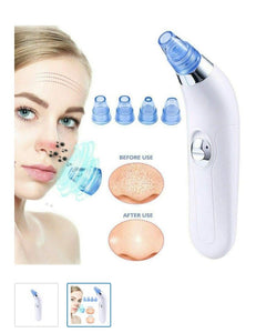 Dermasuction Pore Cleaning